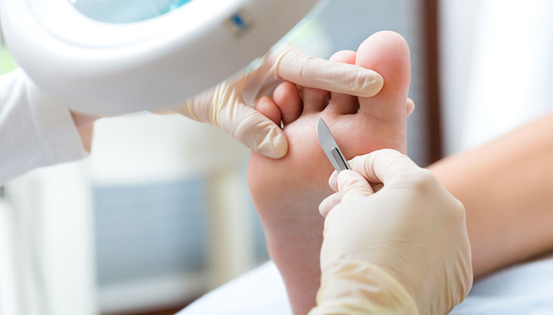 Medical Foot Care Montreal